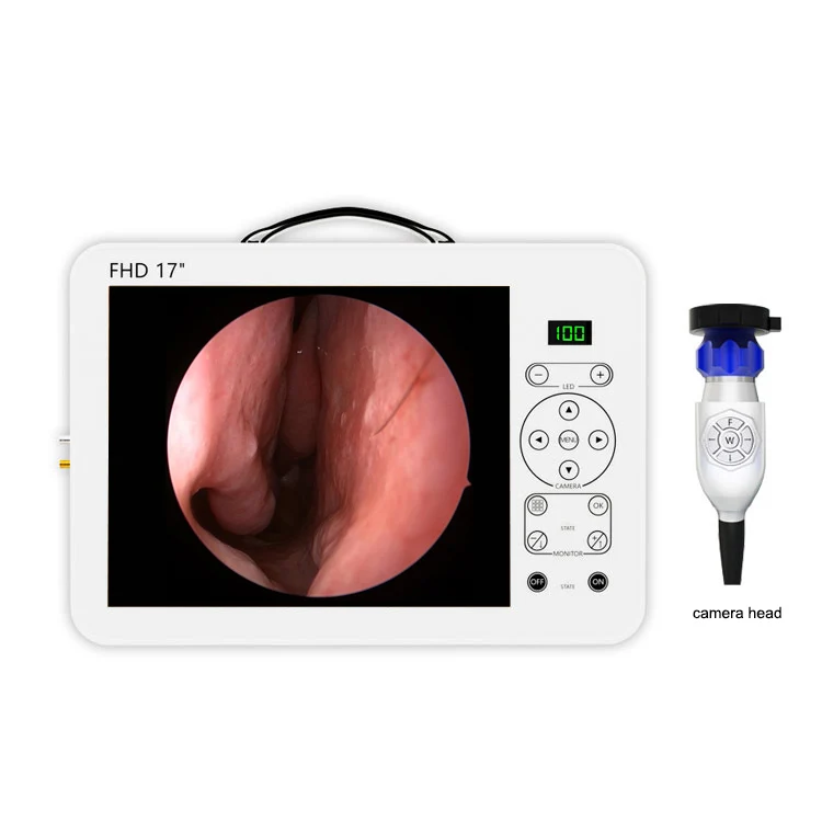 17インチHDビデオ耳鏡耳鼻咽喉科診断システムセット |   - Medical Lab Images のレビューと価格