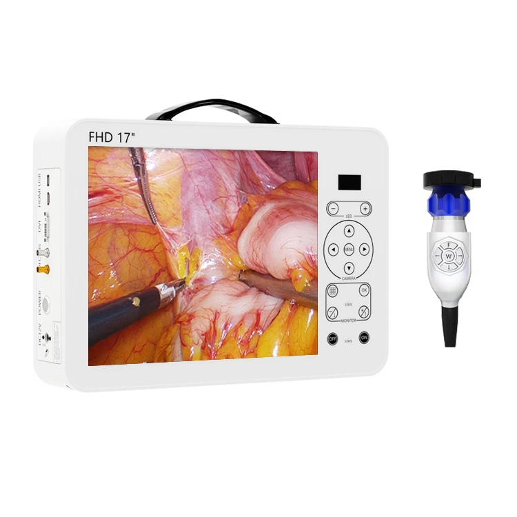 17インチHDビデオ耳鏡耳鼻咽喉科診断システムセット |   - Medical Lab Images のレビューと価格